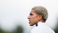Profile view of a person with bleached curly hair looking towards their left wearing a sports jacket.