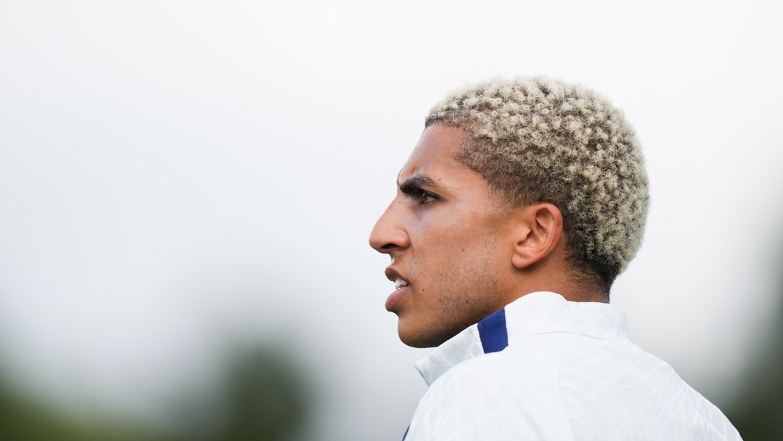 Profile view of a person with bleached curly hair looking towards their left wearing a sports jacket.